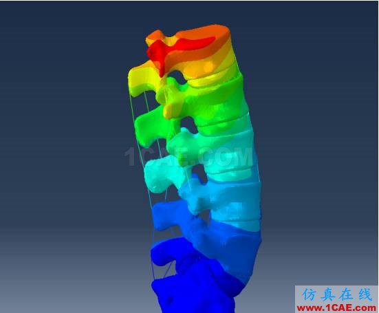 【醫(yī)學(xué)應(yīng)用】骨科知識(shí)和有限元分析ansys圖片3